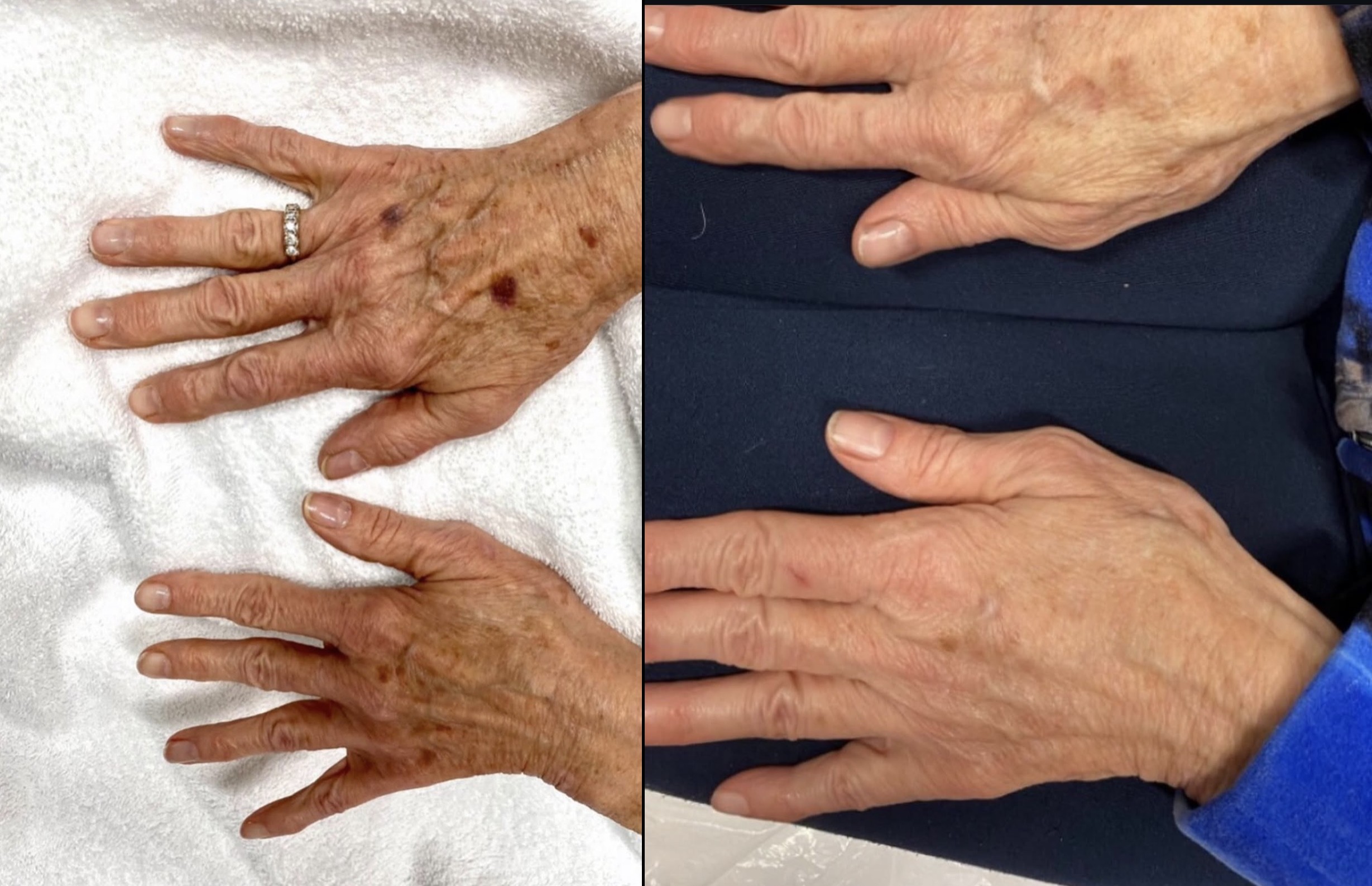 Treatment results 4