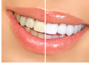 Dental Services